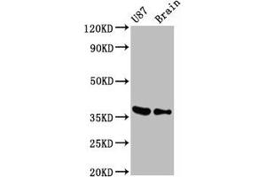 Western Blot Positive WB detected in U87 whole cell lysate 77ouse brain tissue All lanes GAPDH antibody at 0. (Recombinant GAPDH 抗体)