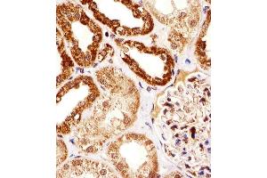 Immunohistochemical analysis of paraffin-embedded H. (SSNA1 抗体  (N-Term))