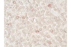 Immunohistochemistry analysis of human tonsil tissue (60x) using LAG-3 (human) recombinant mAb (L4-PL33), at a dilution of 1:50 (LAG3 抗体  (N-Term))