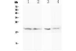 Western blot analysis of BCMA using anti-BCMA antibody .