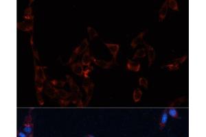Immunofluorescence analysis of NIH/3T3 cells using GPC4 Polyclonal Antibody at dilution of 1:100. (GPC4 抗体)