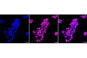 anti-Cyclin-Dependent Kinase Inhibitor 1B (p27, Kip1) (CDKN1B) antibody