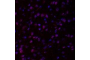 Immunofluorescent analysis of paraformaldehyde-fixed rat brain using,HECTD1 (ABIN7074186) at dilution of 1: 2000 (HECTD1 抗体)