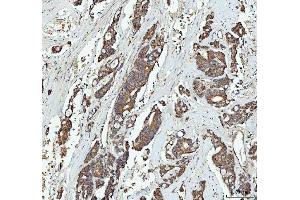 IHC analysis of GRB10 using anti-GRB10 antibody (ABIN7599160). (GRB10 抗体  (AA 1-251))
