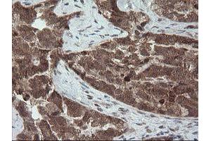 Image no. 8 for anti-Carboxypeptidase A2 (Pancreatic) (CPA2) antibody (ABIN1497598) (Carboxypeptidase A2 抗体)