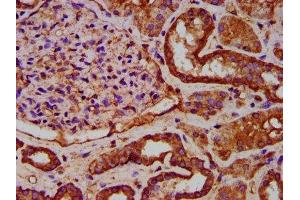 Immunohistochemistry (IHC) image for anti-Elongator Complex Protein 1 (ELP1) (AA 1107-1258) antibody (ABIN7151572)