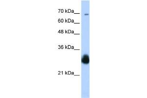 WB Suggested Anti-RNF138 Antibody Titration:  0. (RNF138 抗体  (C-Term))