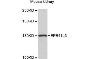 Western blot analysis of extracts of mouse kidney, using EPB41L3 antibody (ABIN6290317) at 1:3000 dilution. (EPB41L3 抗体)