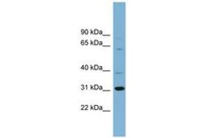 Image no. 1 for anti-Chromosome 22 Open Reading Frame 31 (C22orf31) (AA 71-120) antibody (ABIN6742136) (C22orf31 抗体  (AA 71-120))