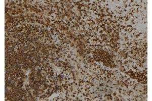 ABIN6260445 and ABIN6266445 at 1/100 staining Human spleen tissue by IHC-P.