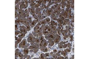 Immunohistochemical staining of human pancreas with KIAA1045 polyclonal antibody  shows strong cytoplasmic positivity in exocrine cells at 1:200-1:500 dilution. (KIAA1045 抗体)