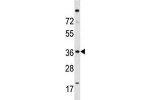 ISL2 antibody western blot analysis in A2058 lysate (ISL2 抗体  (AA 1-30))
