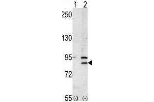 Western blot analysis of BRD2 (arrow) using rabbit polyclonal BRD2 Antibody (Center) (ABIN392609 and ABIN2842131). (BRD2 抗体  (AA 170-200))