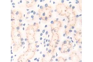 Used in DAB staining on fromalin fixed paraffin- embedded Kidney tissue (CD101 抗体  (AA 666-937))