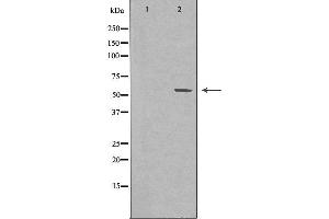 Western blot analysis of extracts from HUVEC cells, using FGR antibody. (Fgr 抗体  (Internal Region))