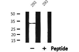 Western blot analysis of extracts from 293, using SLC25A6 Antibody. (SLC25A6 抗体  (Internal Region))