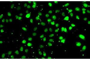 Immunofluorescence analysis of HeLa cells using NUDT2 Polyclonal Antibody (NUDT2 抗体)