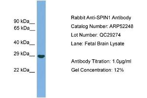 WB Suggested Anti-SPIN1  Antibody Titration: 0. (Spindlin 1 抗体  (Middle Region))