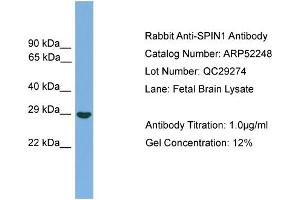 WB Suggested Anti-SPIN1  Antibody Titration: 0.