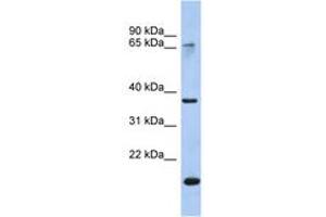 Image no. 1 for anti-Annexin A10 (ANXA10) (AA 179-228) antibody (ABIN6742711) (Annexin a10 抗体  (AA 179-228))