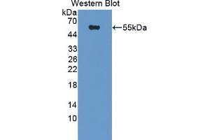 Western blot analysis of the recombinant protein. (DPP7 抗体  (AA 28-486))