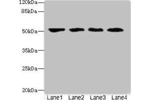 Western blot All lanes: LRRC42 antibody at 10 μg/mL Lane 1: MCF-7 whole cell lysate Lane 2: A549 whole cell lysate Lane 3: HCT116 whole cell lysate Lane 4: Colo320 whole cell lysate Secondary Goat polyclonal to rabbit IgG at 1/10000 dilution Predicted band size: 49 kDa Observed band size: 49 kDa (LRRC42 抗体  (AA 201-428))