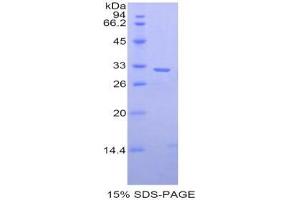 SDS-PAGE analysis of Human MP1 Protein. (PITRM1 蛋白)