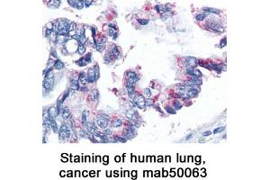 Image no. 1 for anti-Baculoviral IAP Repeat-Containing 5 (BIRC5) antibody (ABIN363217) (Survivin 抗体)