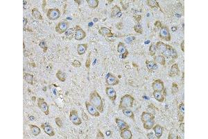 Immunohistochemistry of paraffin-embedded Mouse brain using PDIA6 Polyclonal Antibody at dilution of 1:100 (40x lens). (PDIA6 抗体)