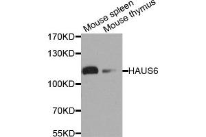 Western blot analysis of extract of mouse spleen and mouse thymus cells, using HAUS6 antibody. (FAM29A 抗体)