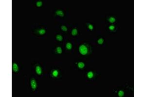 Immunofluorescent analysis of HepG2 cells using ABIN7153807 at dilution of 1:100 and Alexa Fluor 488-congugated AffiniPure Goat Anti-Rabbit IgG(H+L) (GTF2H5 抗体  (AA 1-71))
