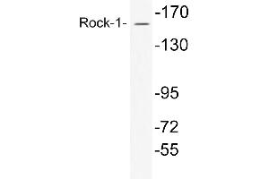 Western blot (WB) analysis of Rock-1 antibody in extracts from COS7 cells. (ROCK1 抗体)