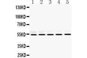Western Blotting (WB) image for anti-Retinoblastoma Binding Protein 4 (RBBP4) (AA 395-425), (C-Term) antibody (ABIN3043920) (Retinoblastoma Binding Protein 4 抗体  (C-Term))