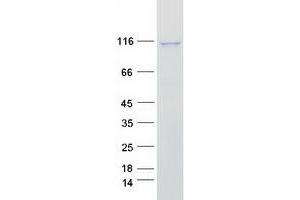 Validation with Western Blot (IDE Protein (Myc-DYKDDDDK Tag))