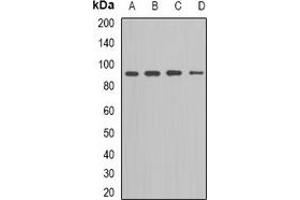 Western blot analysis of Kv11. (KCNH2 抗体)