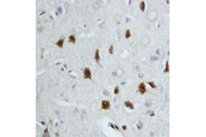 Immunohistochemistry (IHC) image for anti-Heat Shock 70kDa Protein 8 (HSPA8) (AA 13-31), (N-Term) antibody (ABIN3044300)