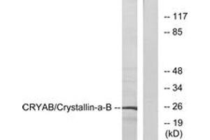 Western blot analysis of extracts from 293 cells, using CRYAB (Ab-19) Antibody. (CRYAB 抗体  (AA 10-59))