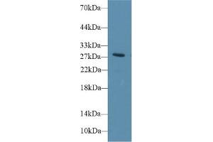 Detection of DIO3 in Rat Blood Cells lysate using Polyclonal Antibody to Deiodinase, Iodothyronine, Type III (DIO3) (DIO3 抗体  (AA 37-169))