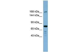 WB Suggested Anti-DAPK1 Antibody Titration: 0. (DAP Kinase 1 抗体  (N-Term))