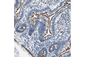 Immunohistochemical staining of human small intestine with TMEM180 polyclonal antibody  shows distinct granular cytoplasmic positivity in glandular cells at 1:20-1:50 dilution. (TMEM180 抗体)