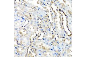 Immunohistochemistry of paraffin-embedded rat kidney using HYAL1 antibody (ABIN5975045) at dilution of 1/100 (40x lens). (HYAL1 抗体)