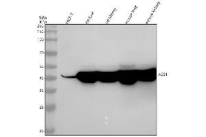 Western blot analysis of ASS1 using anti-ASS1 antibody (ABIN7604048).