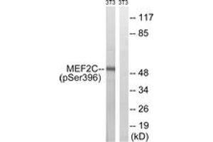 Western blot analysis of extracts from NIH-3T3 cells treated with starved 24h, using MEF2C (Phospho-Ser396) Antibody. (MEF2C 抗体  (pSer396))