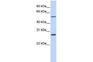 WB Suggested Anti-RNF217 Antibody Titration:  0. (RNF217 抗体  (Middle Region))