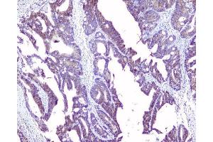 IHC analysis of SRI using anti-SRI antibody (ABIN6719388). (SRI 抗体)