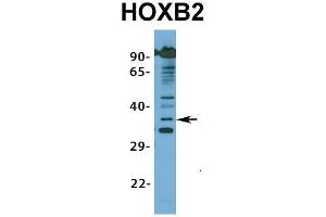 Western Blotting (WB) image for anti-Homeobox B2 (HOXB2) (N-Term) antibody (ABIN2776384)