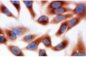 Anti-Calpain 1 antibody, ICC ICC: HELA Cell (CAPNL1 抗体  (Middle Region))