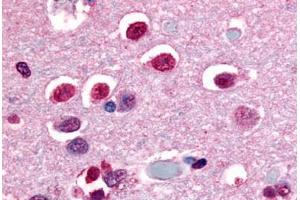 Anti-NR4A3 antibody  ABIN1049142 IHC staining of human brain, neurons and glia. (NR4A3 抗体  (C-Term))