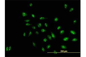 Immunofluorescence of purified MaxPab antibody to D21S2056E on HeLa cell. (RRP1 抗体  (AA 1-461))