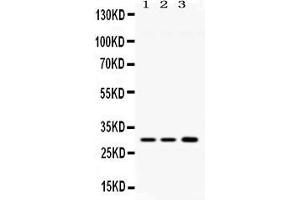 Western blot analysis of AQP11 expression in rat brain extract ( Lane 1), mouse brain extract ( Lane 2) and HELA whole cell lysates ( Lane 3). (AQP11 抗体  (N-Term))